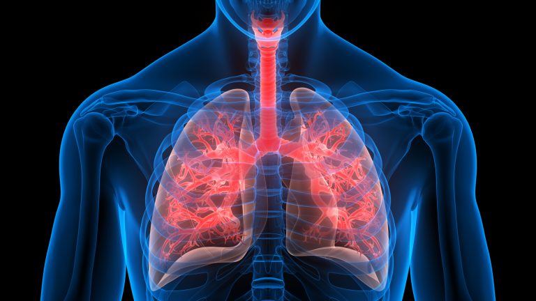 U-M researchers awarded $500K grant to develop a Cystic Fibrosis Research Center at the University of Michigan