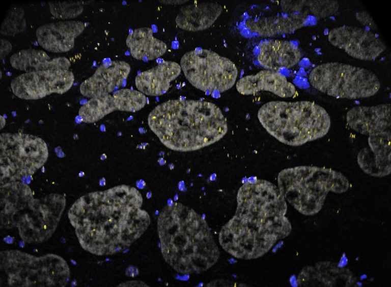 Researchers in the Moon Lab publish findings on how emergency response RNAs avoid condensation during stress – a discovery that could help fight disease